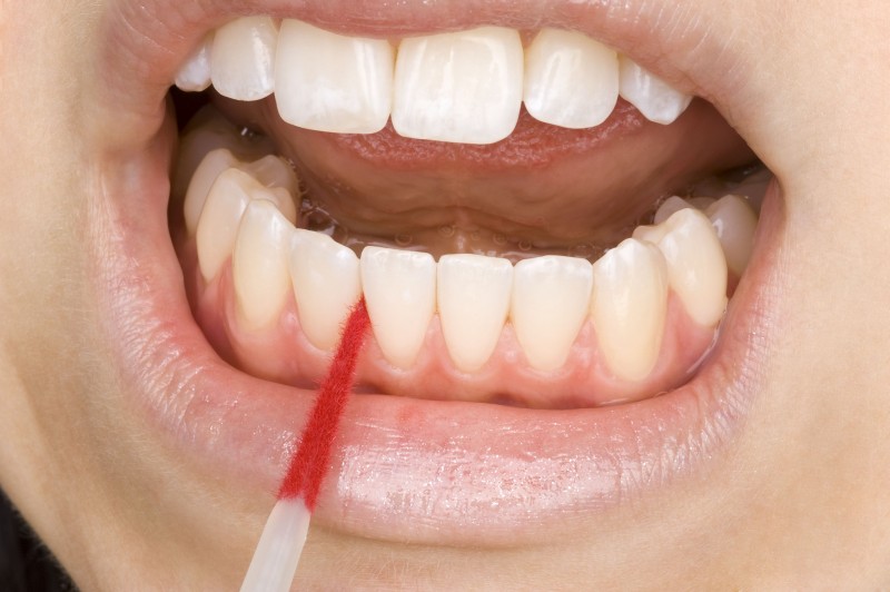 Getting Gum Therapy in Midwest City OK to Prevent Gum Disease