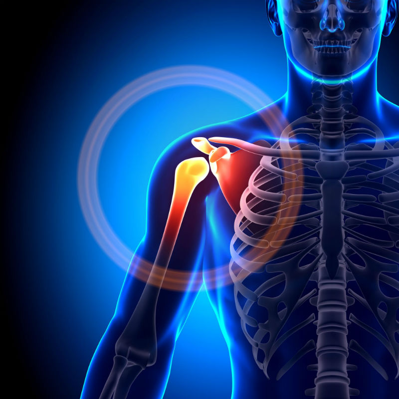 Do You Need a Rockwall TX Specialist for Shoulder Pain Treatment?