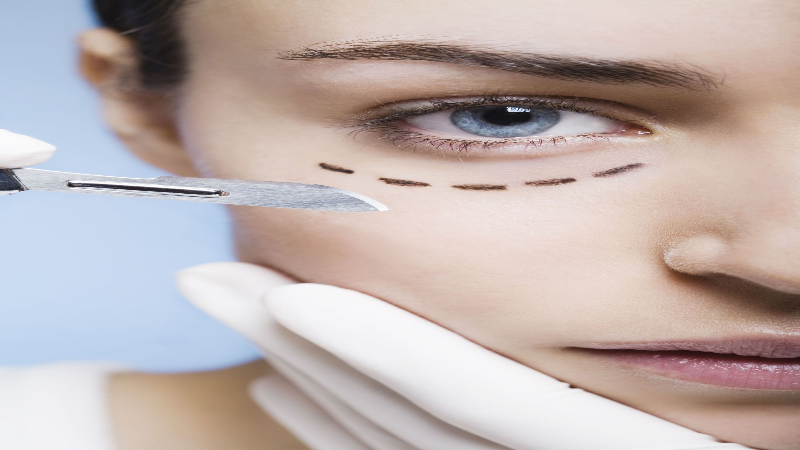 Reasons to Consider Getting Botox Near Otsego, MN